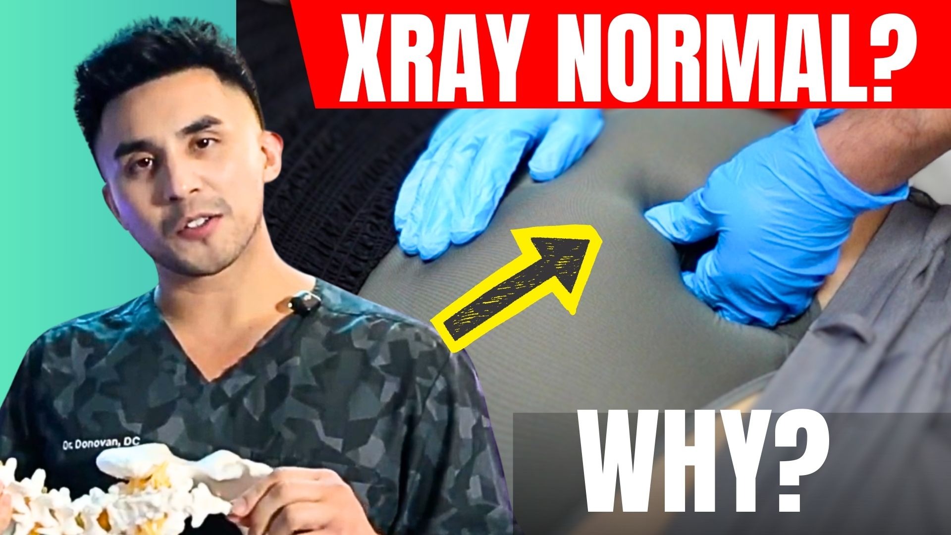  Tailbone *COCCYX* Pain Explained Causes, Symptoms, & Best Treatment Options thumbnail