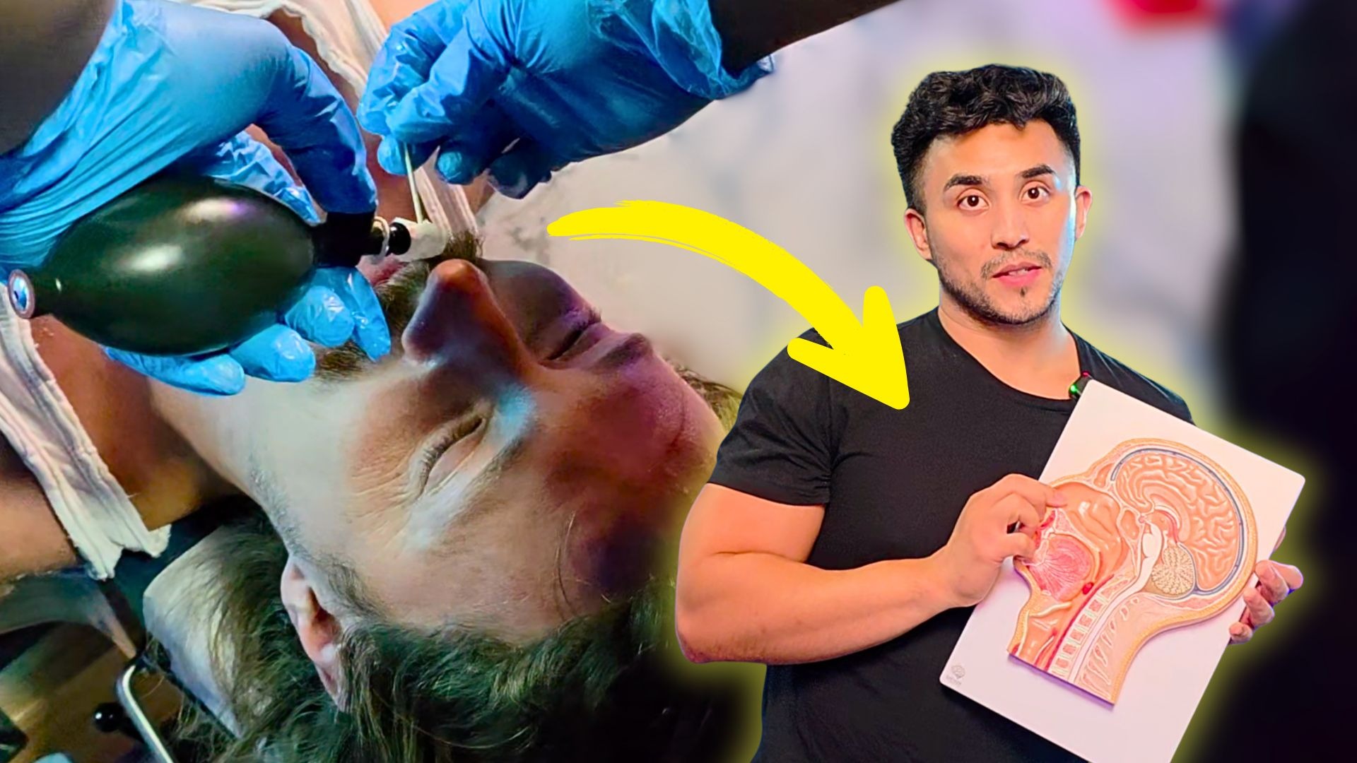 Flew From Poland For The Nasal Balloon *Cranial Facial Release* thumbnail