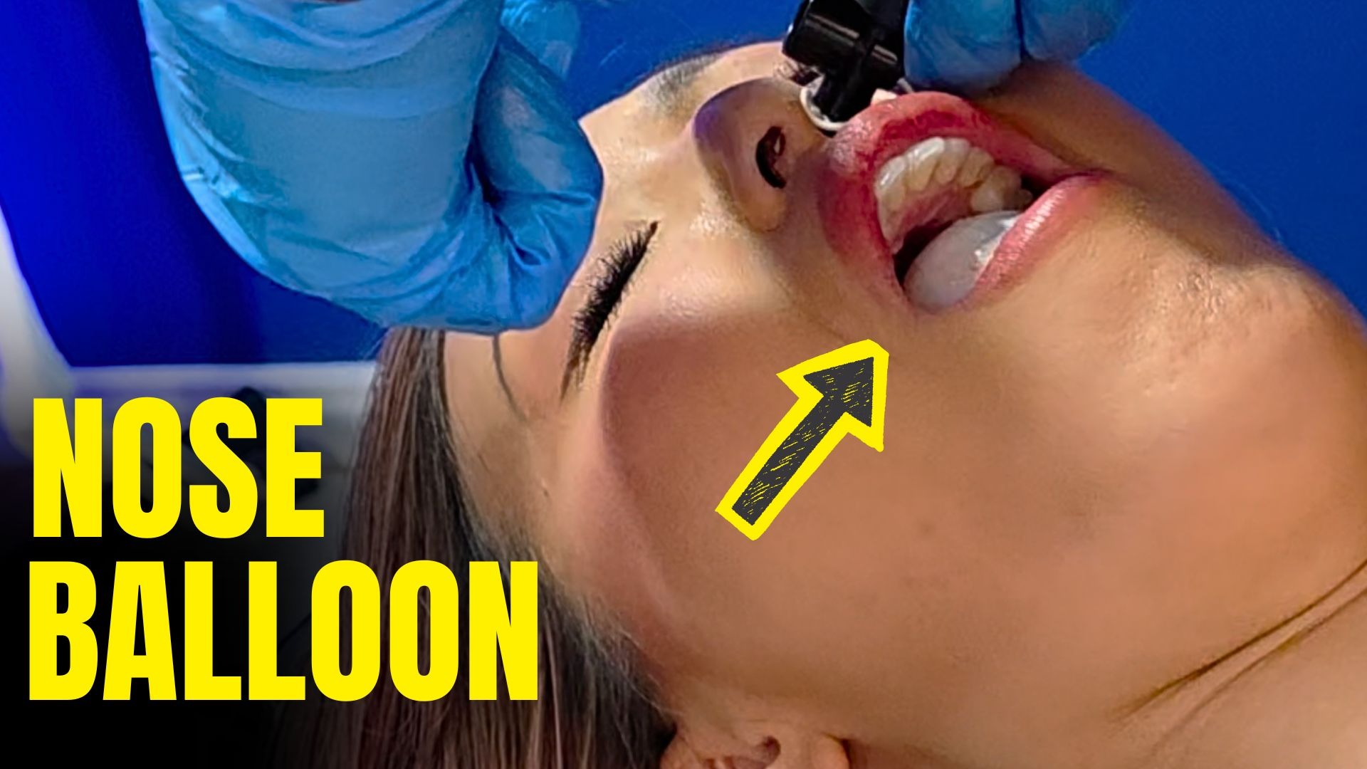  She Was Dropped on Her Head as a Kid So I Fixed It With a Balloon 😳 thumbnail