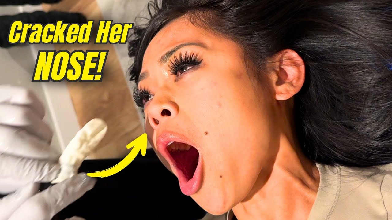 Nasal Balloon Technique For Her Breathing Issues thumbnail