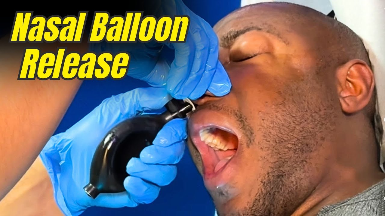 Singing Voice Got Better After This! | Cranial Facial Release Results thumbnail