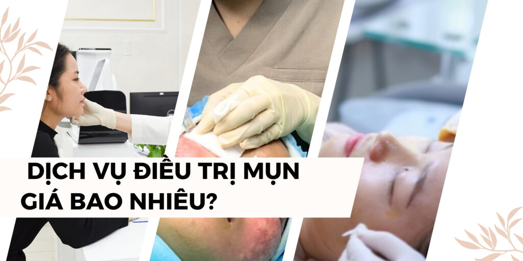 Dịch Vụ điều Trị Mụn Gồm Những Gì? Giá Bao Nhiêu Một Liệu Trình thumbnail