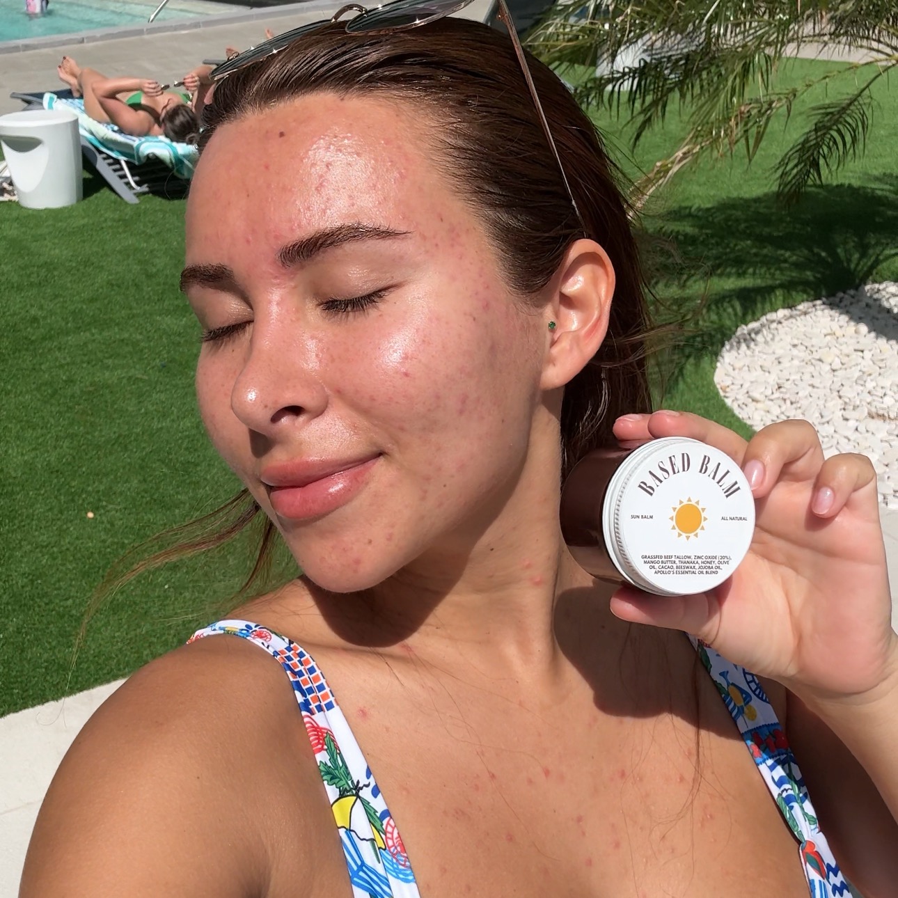 This saved me from ACNE! thumbnail
