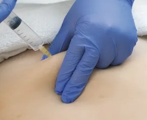 Ozonioterapia thumbnail