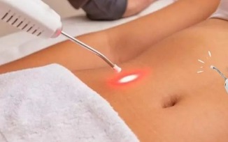 Laserterapia thumbnail