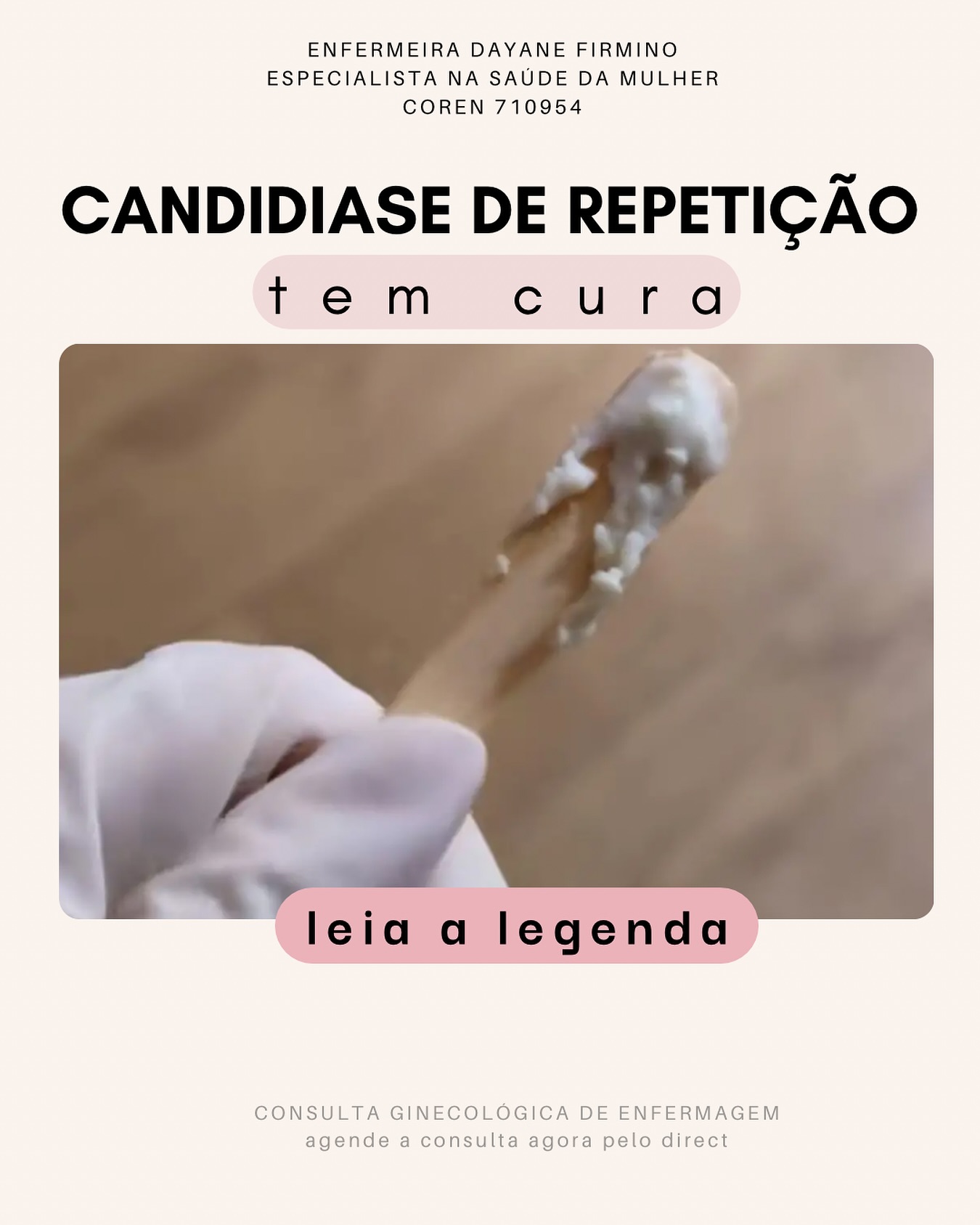 A candidíase de repetição é uma condição que afeta muitas mulheres, mas é importante saber que ela tem cura! Os sintomas