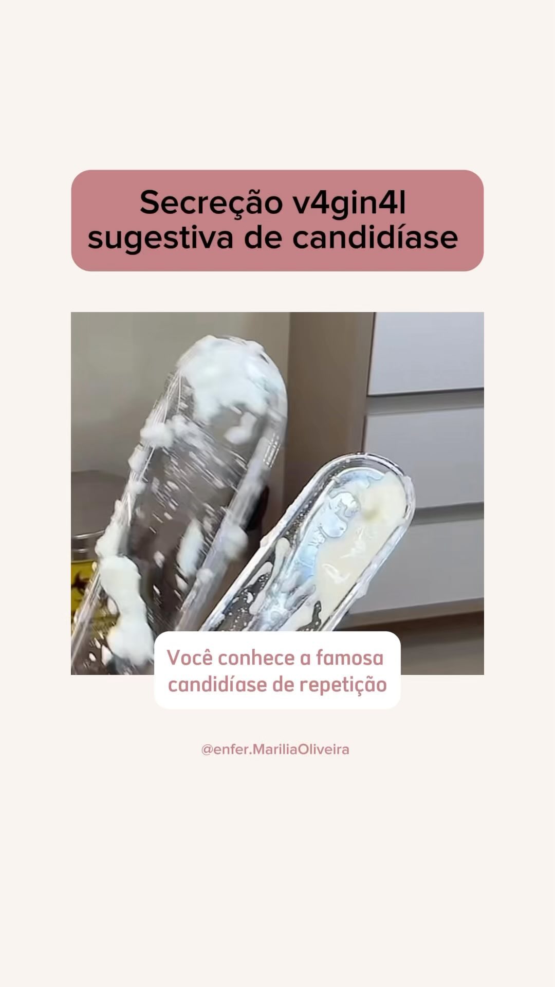 Se você parou aqui nesse vídeo, tenho certeza que você já passou por isso.

A candidíase não é fácil de cuidar, precisa 