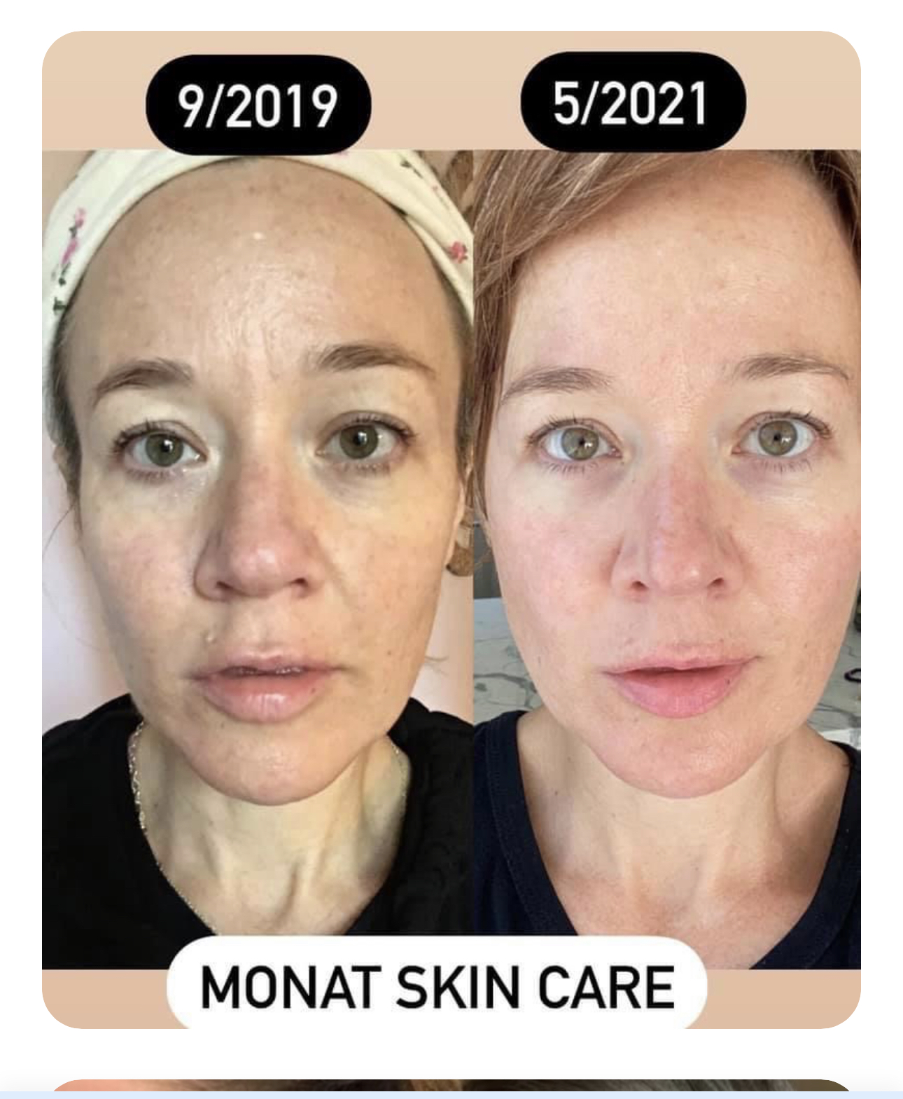 Skincare Testimonials  thumbnail