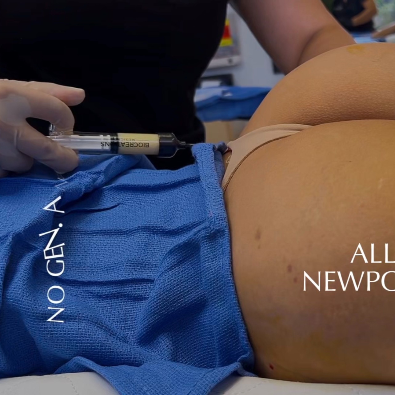 PAYMENT PLANS CHERRY - AWAKE LIPO & ALLOCLAE thumbnail