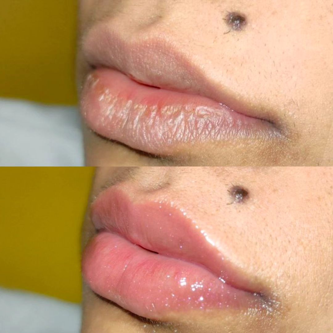 Você cuida da SAÚDE dos seus LÁBIOS? 👄
Os lábios são naturalmente mais finos e sensíveis do que outras áreas da pele. El