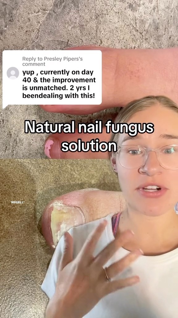 The nail fungus kits sell out almost every time I share about them, but they are now FULLY stocked and ready to ship out