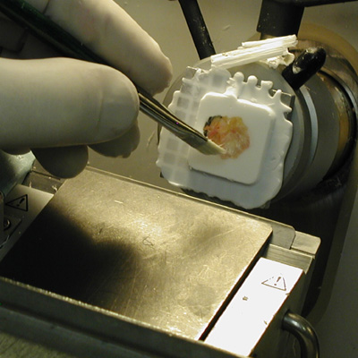 Frozen Section Technique thumbnail