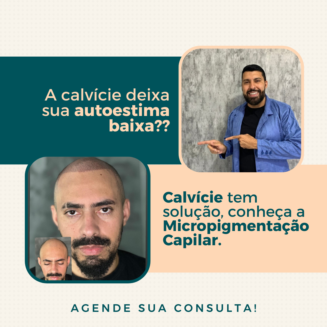 MICRIPIGMENTAÇÃO CAPILAR thumbnail