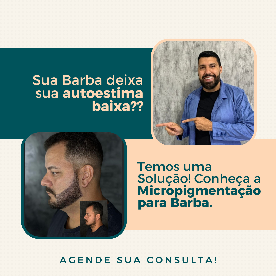 MICROPIGMENTAÇÃO BARBA thumbnail