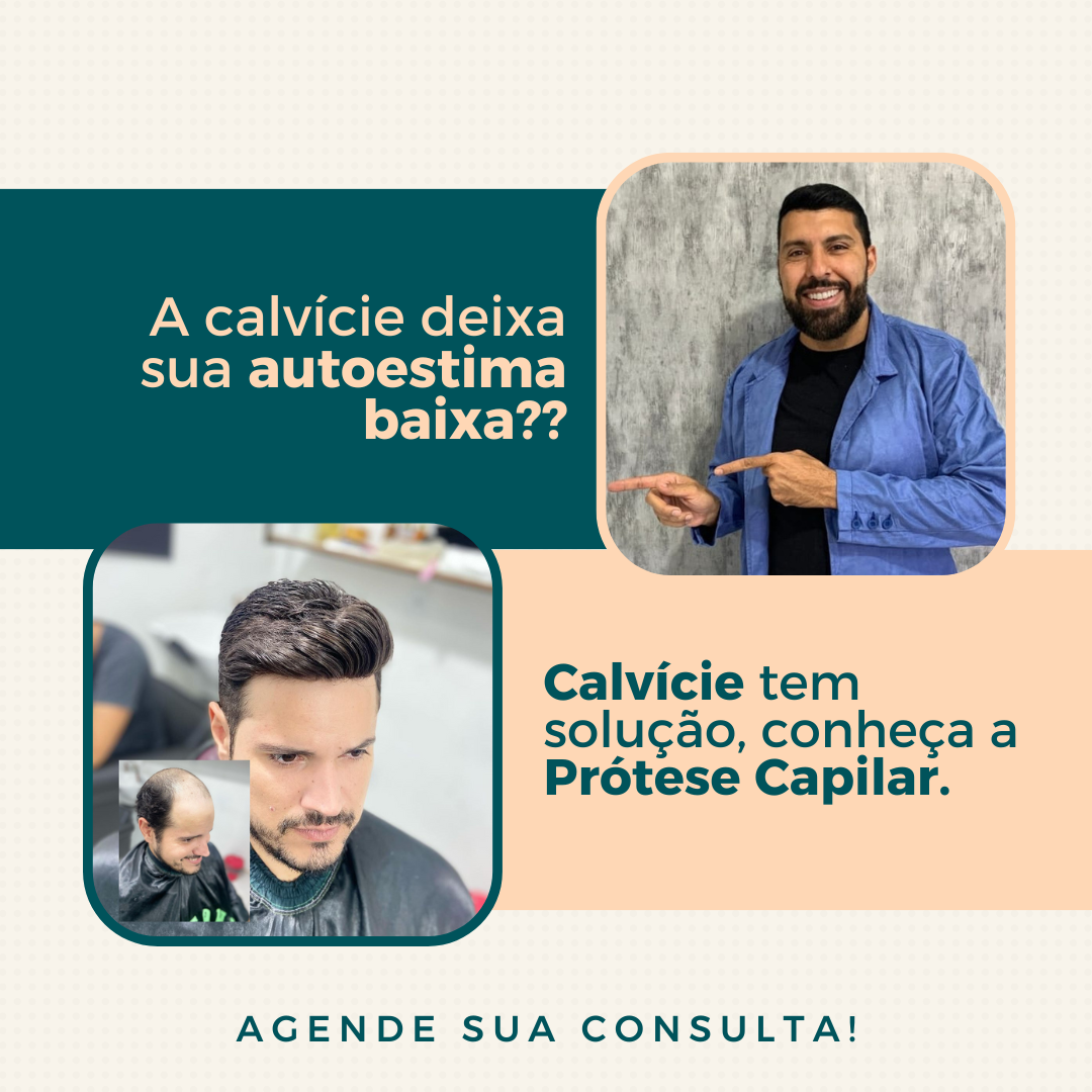 PRÓTESE CAPILAR thumbnail