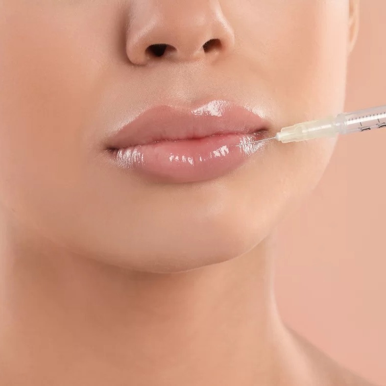 Volumização Labial thumbnail
