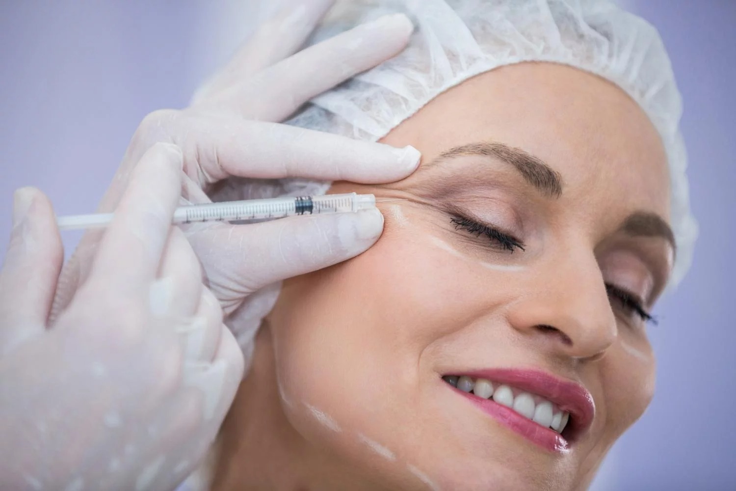 Botox thumbnail