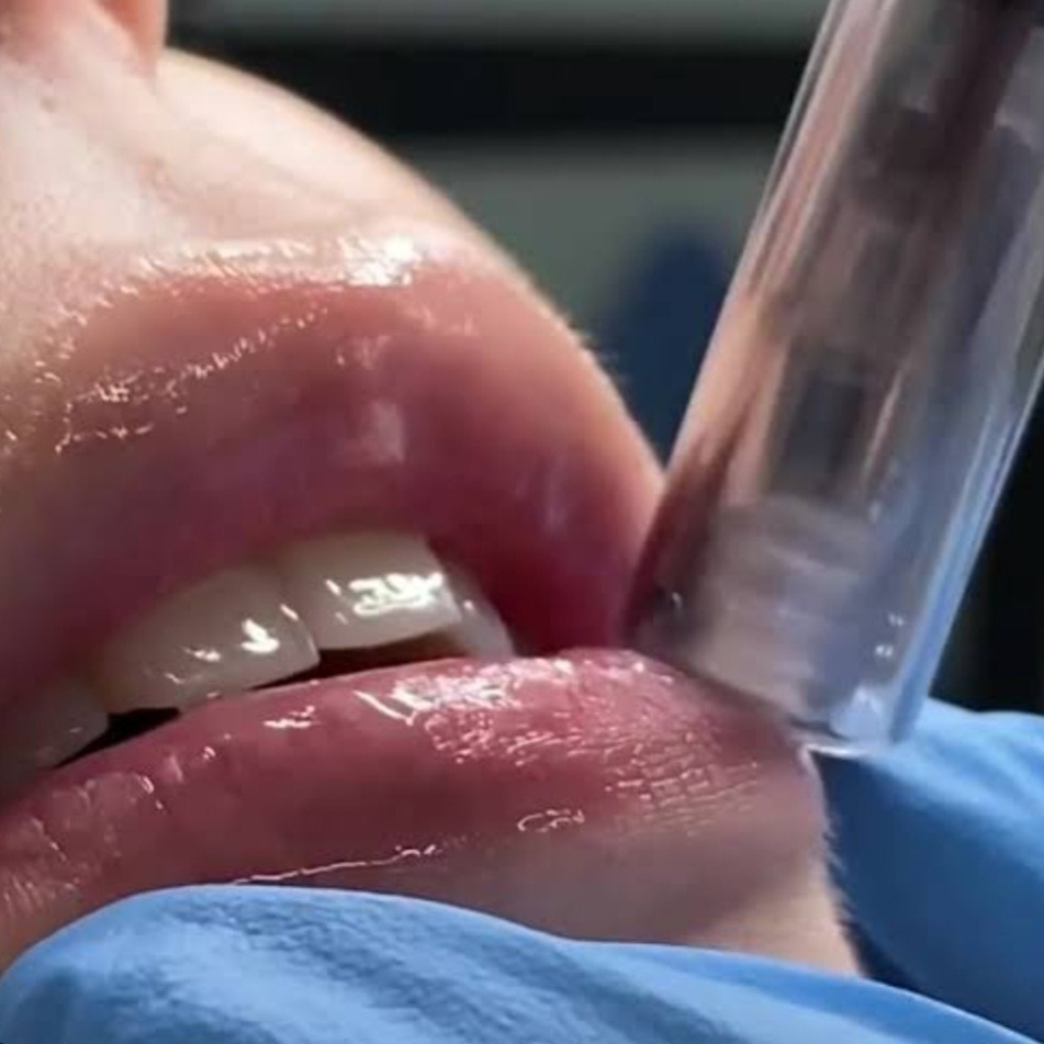 BB Lips thumbnail