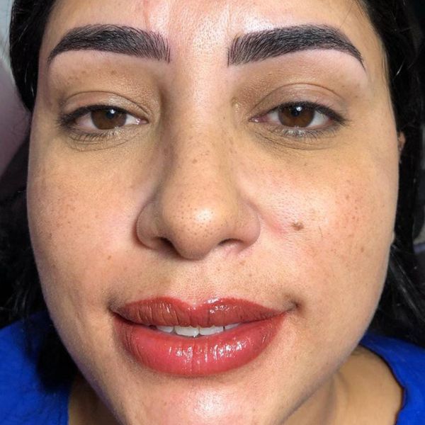 MICROPIGMENTAÇÃO COMPLETA thumbnail