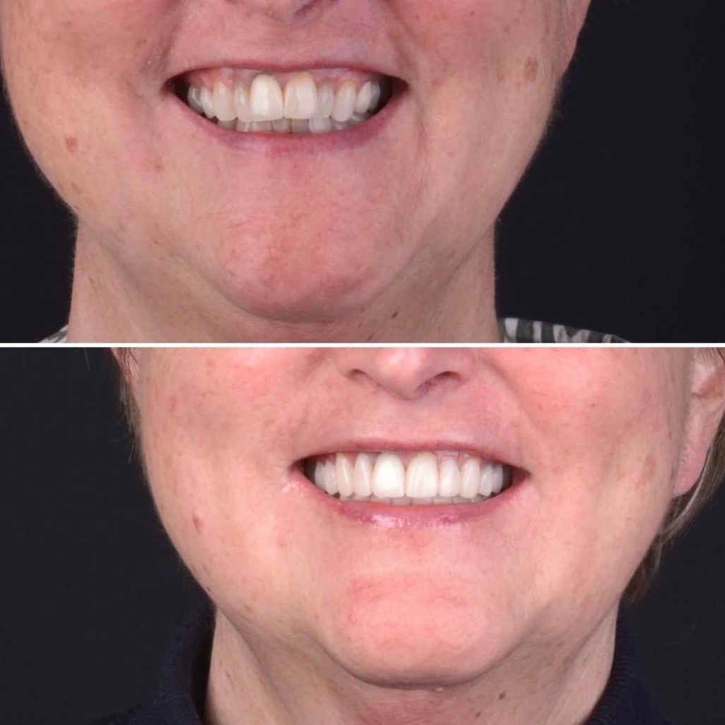 ORTHODONTIE MODERNE ET OPTIMISÉE &  CLEAR ALIGNERS thumbnail