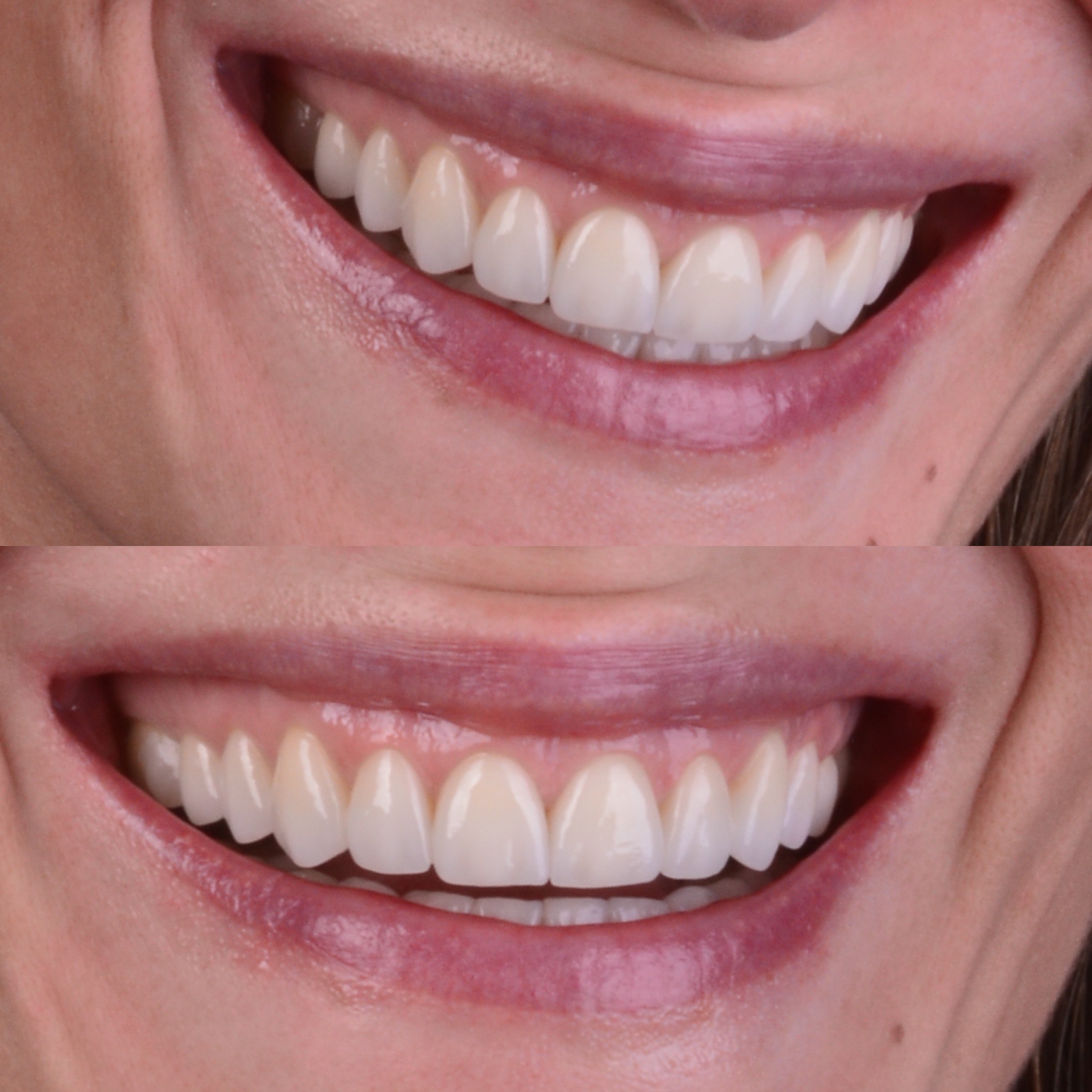 ERCUS SMILE thumbnail