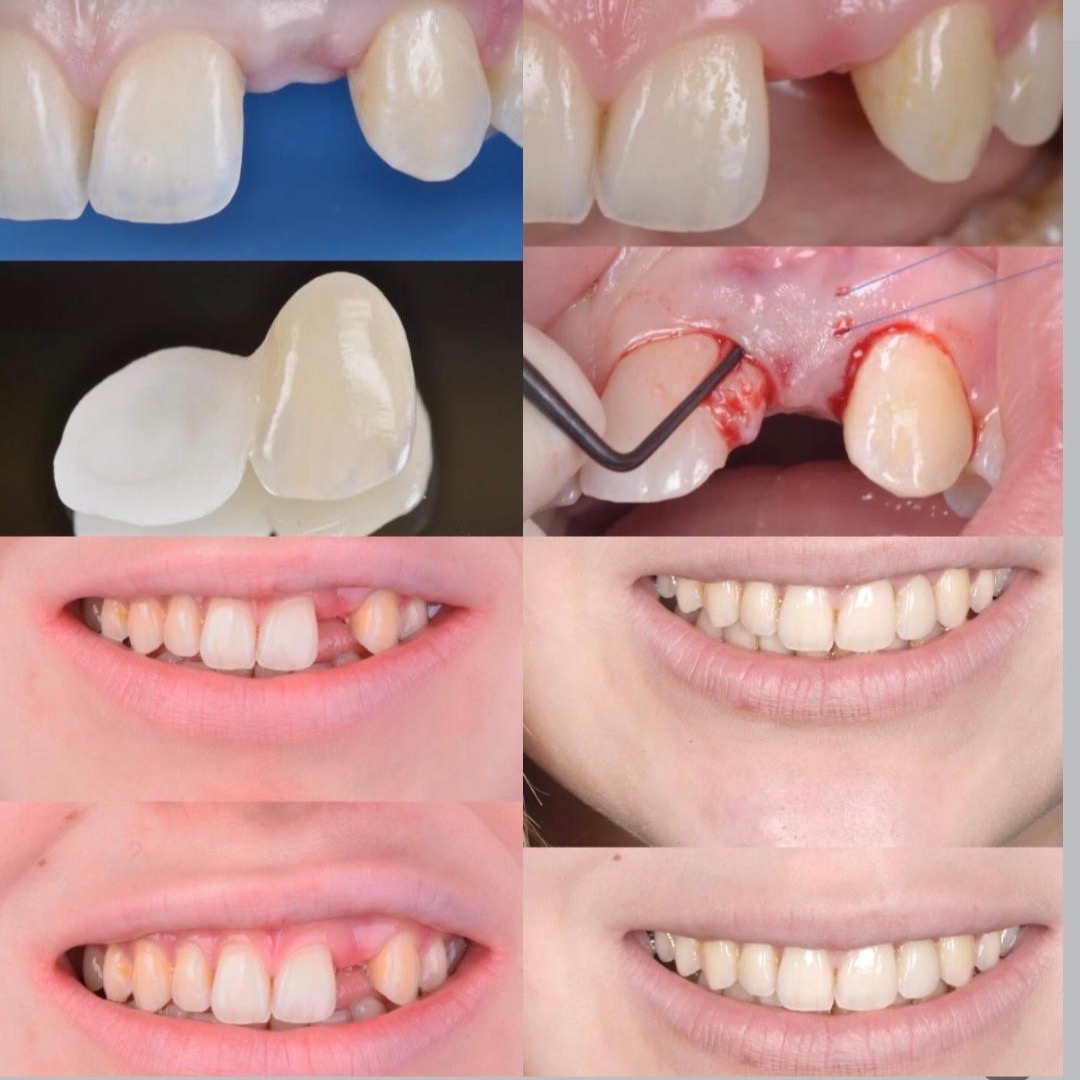 ESTHÉTIQUE & ADHESIVE DENTISTRY thumbnail