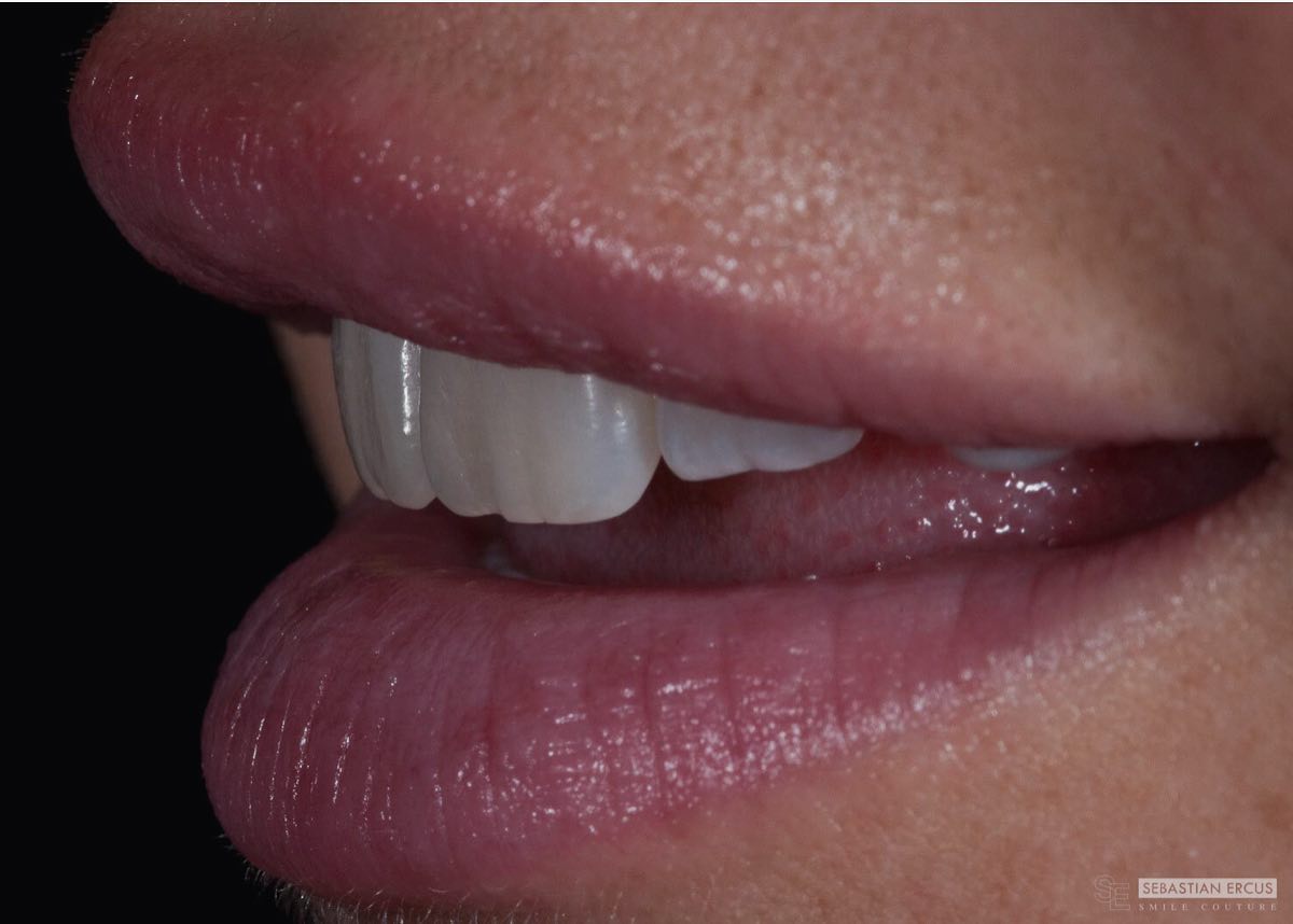 Real...Natural lips , natural smile ... or not ...