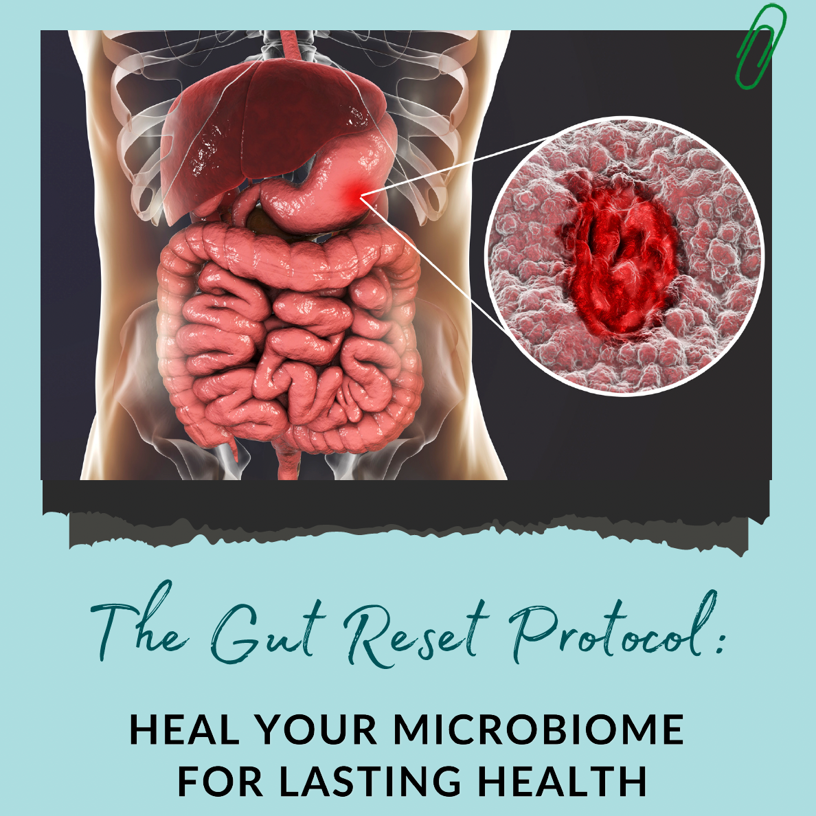 The Gut Reset Protocol thumbnail