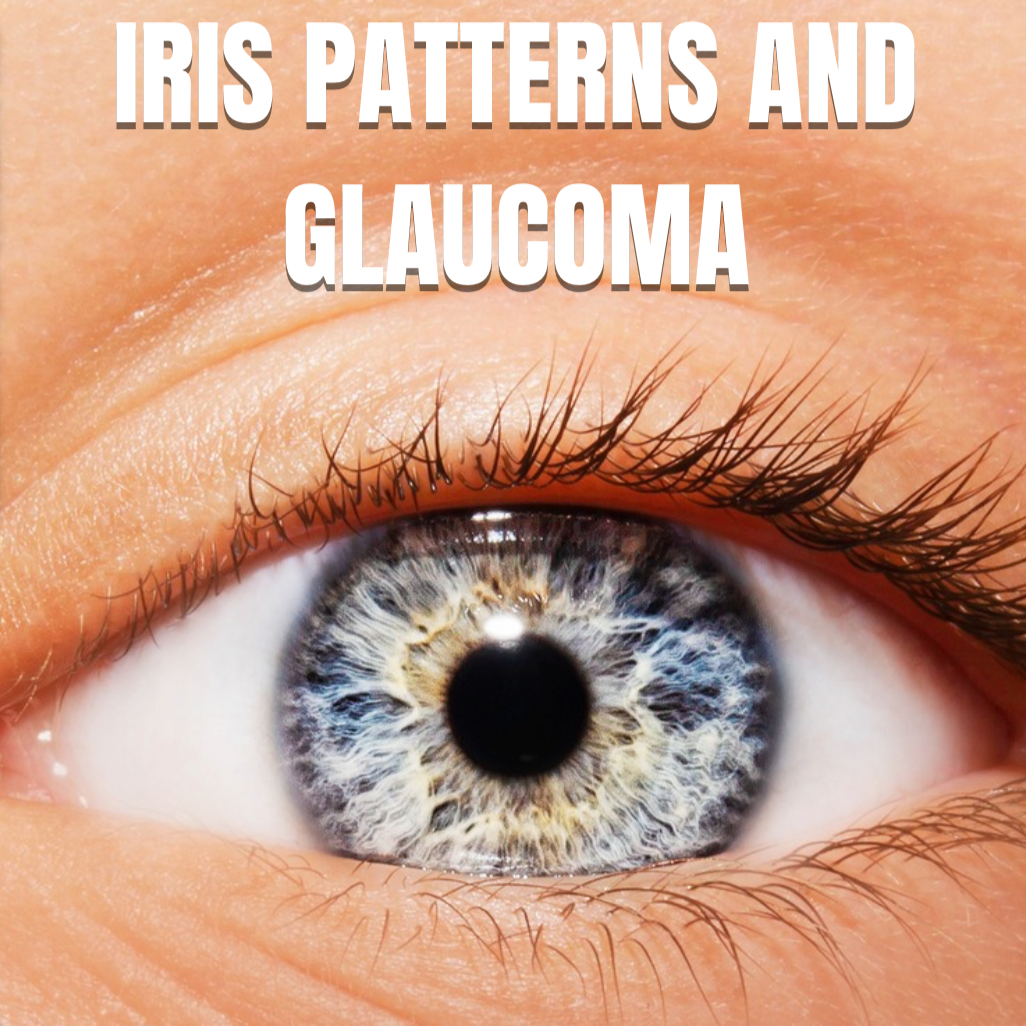 BOOK: Iris Patterns and Glaucoma thumbnail