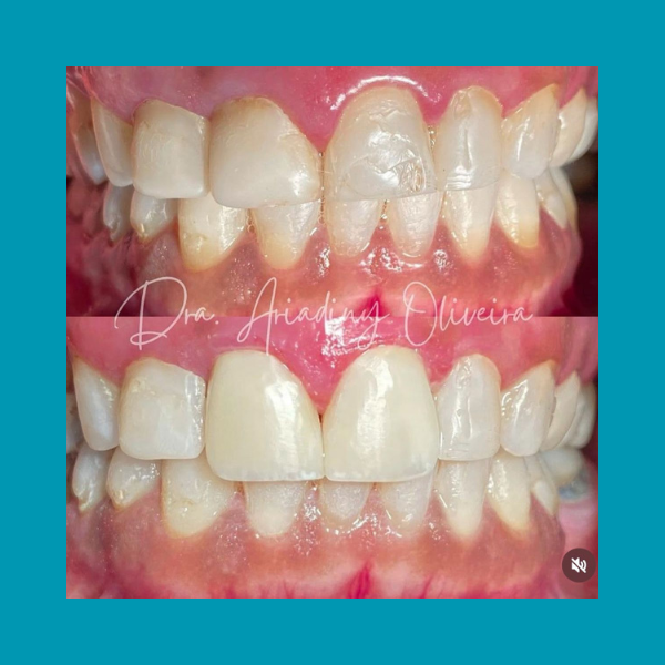 Click aqui☝️ thumbnail