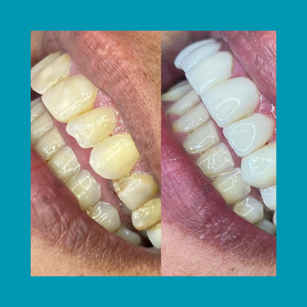 Click aqui☝️ thumbnail