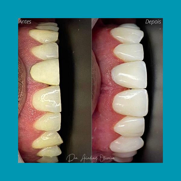 Click aqui☝️ thumbnail