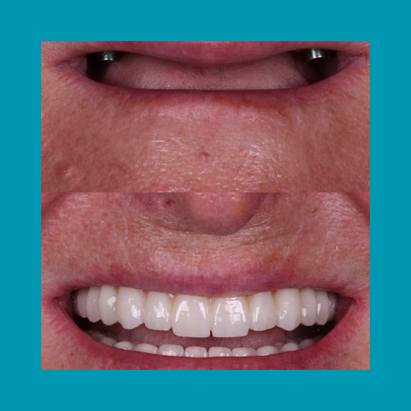 Click aqui☝️ thumbnail