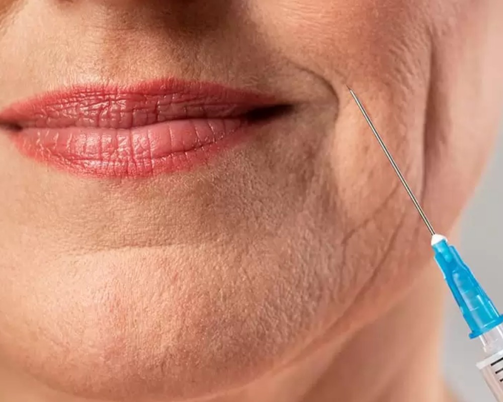 Preenchimento bigode chinês thumbnail