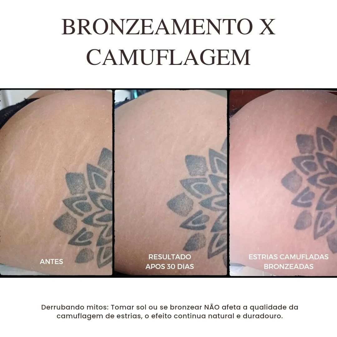 ✨ Desvendando o mito da camuflagem de estrias! ✨

Muita gente acredita que a camuflagem mancha após tomar sol ou bronzea