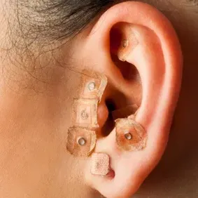 Agendamento Auriculoterapia - Saúde em Ponto thumbnail