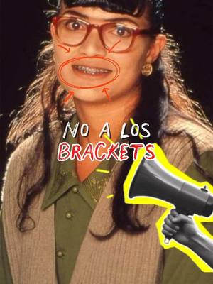 Ya no tendré dientes torcidosss, eso sí que no! Todo gracias a Wizz 💜 #ortondoncia #brackets #fyp #ortodonciainvisible 