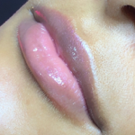 AGENDAMENTO - GLOW LIPS thumbnail