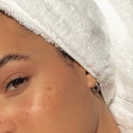 TAKE THIS FREE SKIN CONSULTATION thumbnail