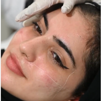 Dr sara elbasiouny thumbnail