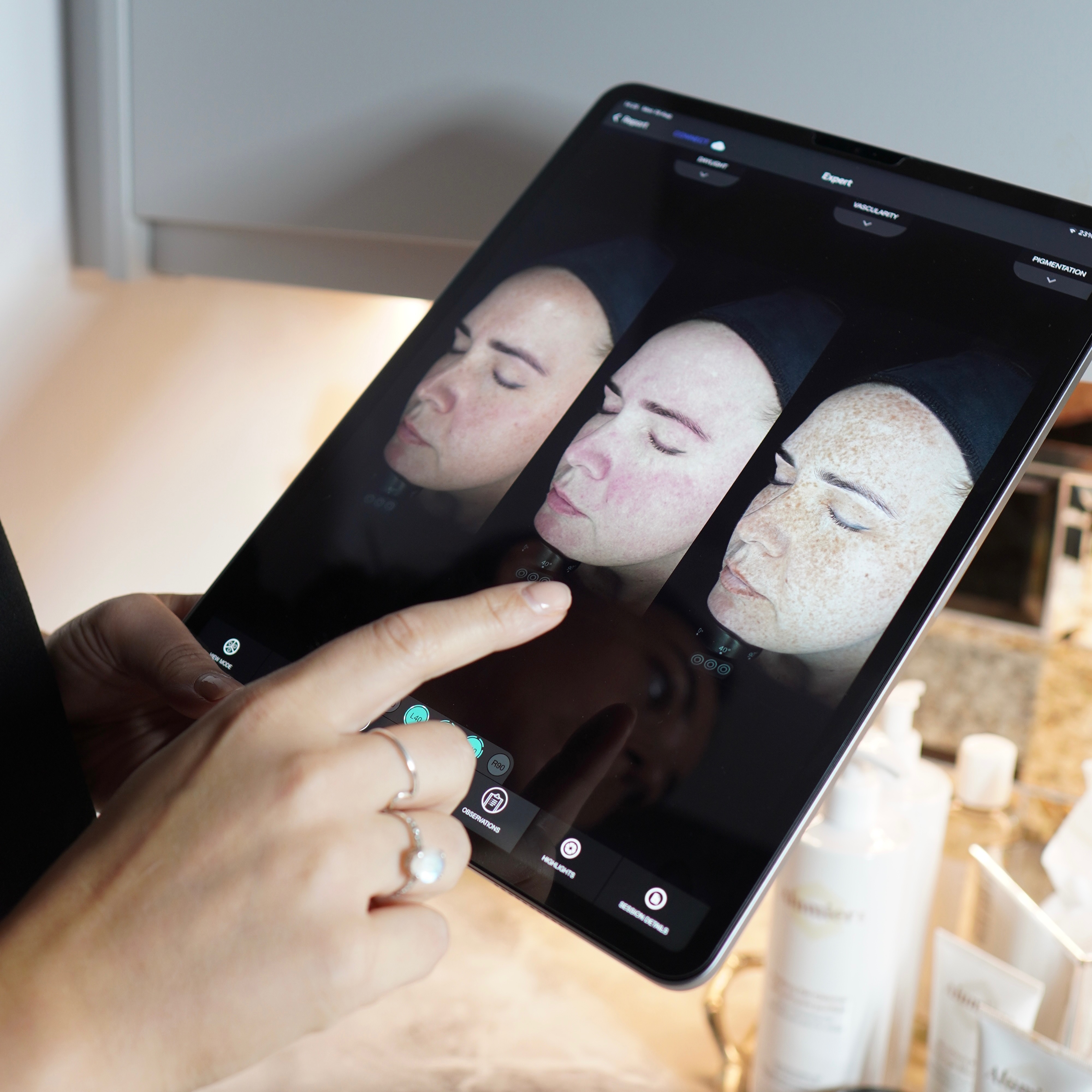 Skin Consultation thumbnail