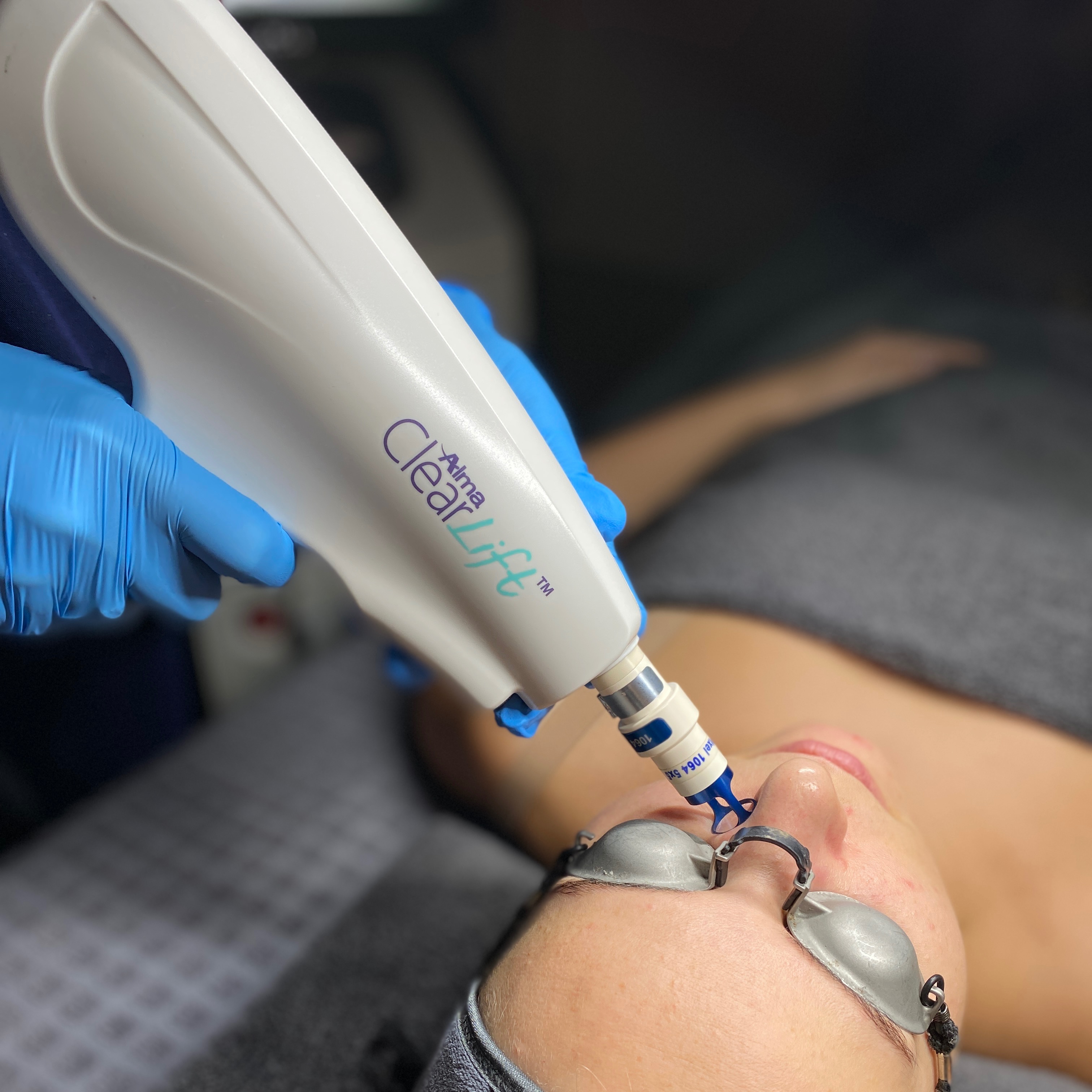 Clearlift Laser  thumbnail