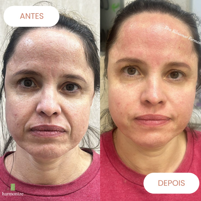 Conheça o Harmonize Estetica/ thumbnail