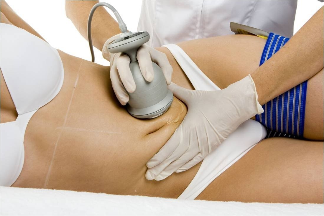 Endermoterapia thumbnail