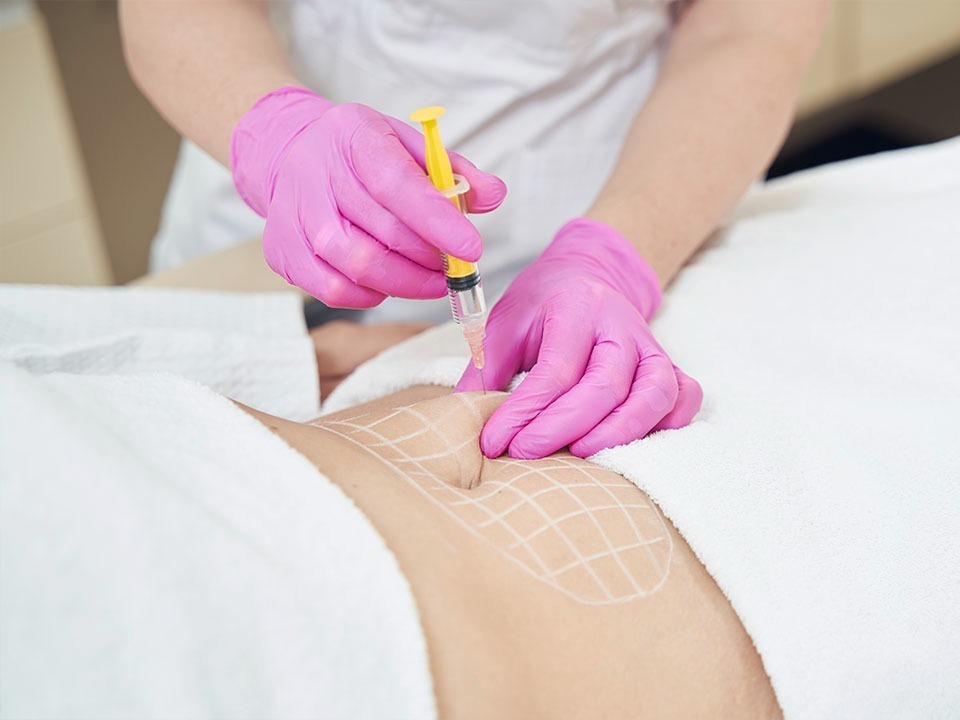 Intradermoterapia - Enzimas thumbnail