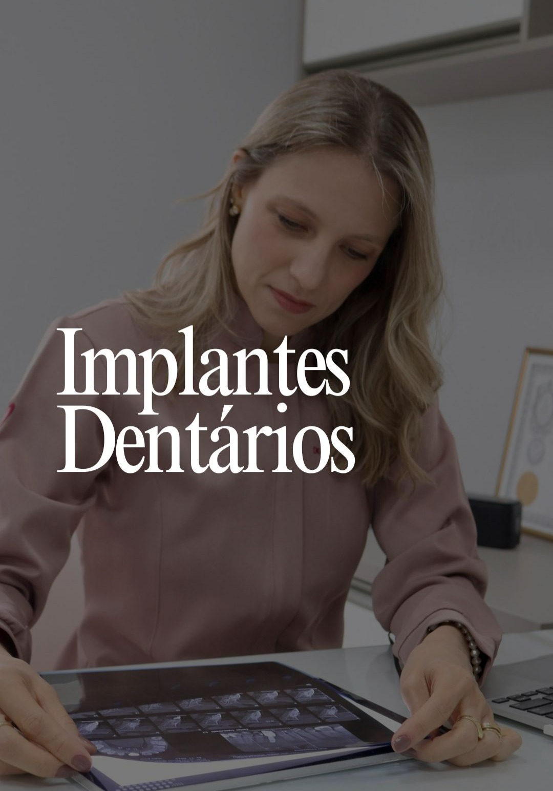Implantes Dentários thumbnail