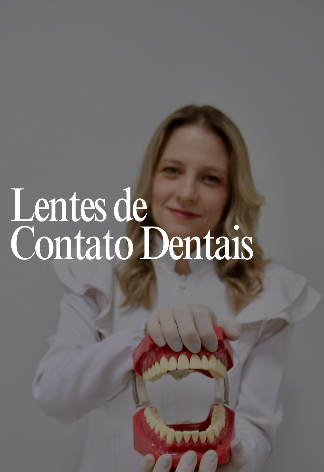 Lentes de Contato Dentais thumbnail