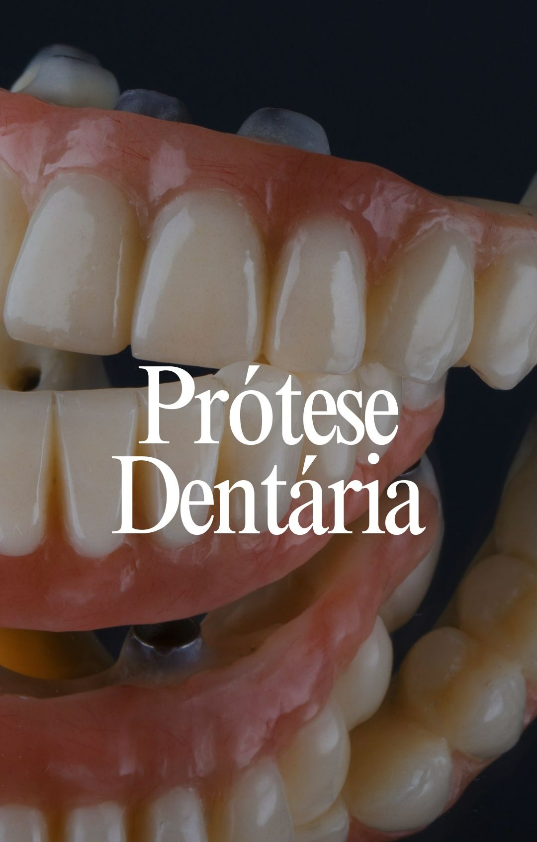  Prótese Dentária thumbnail