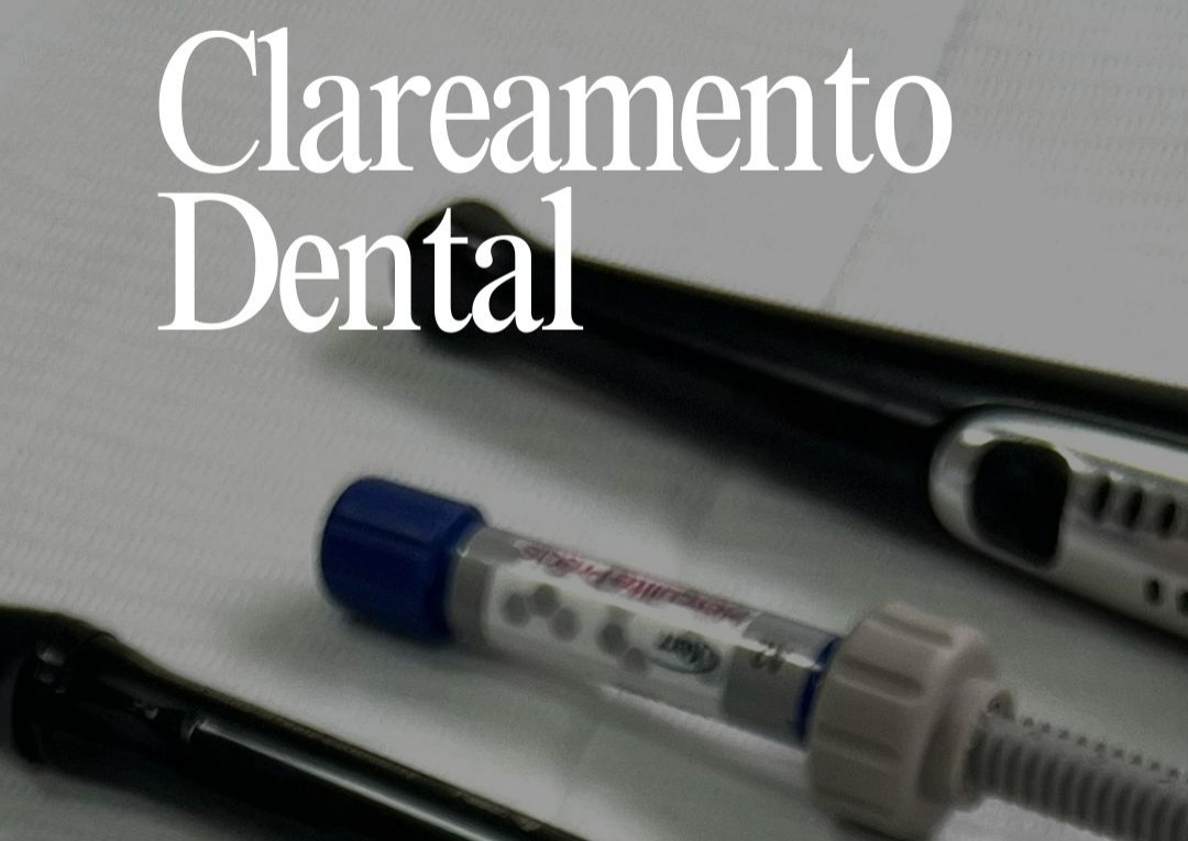 Clareamento Dental thumbnail