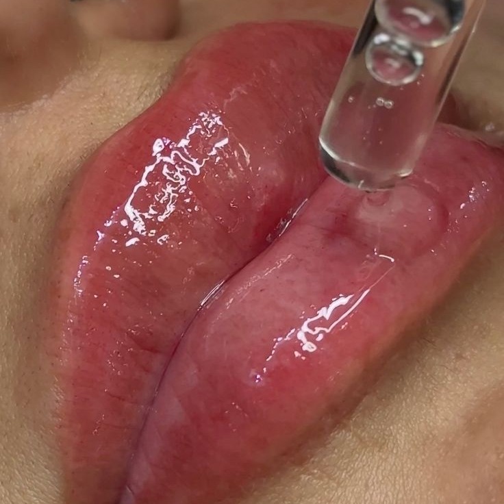 Hidragloss Lips  thumbnail